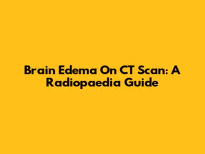 Brain Edema On CT Scan: A Radiopaedia Guide