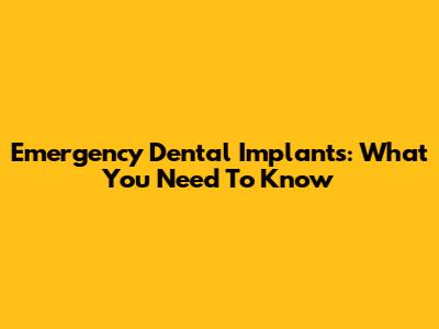 Emergency Dental Implants: What You Need To Know