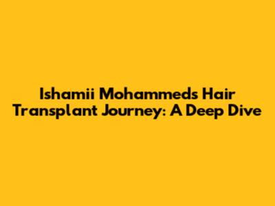 Ishamii Mohammed's Hair Transplant Journey: A Deep Dive