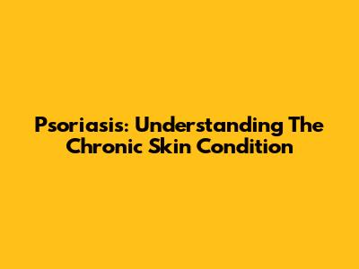 Psoriasis: Understanding The Chronic Skin Condition